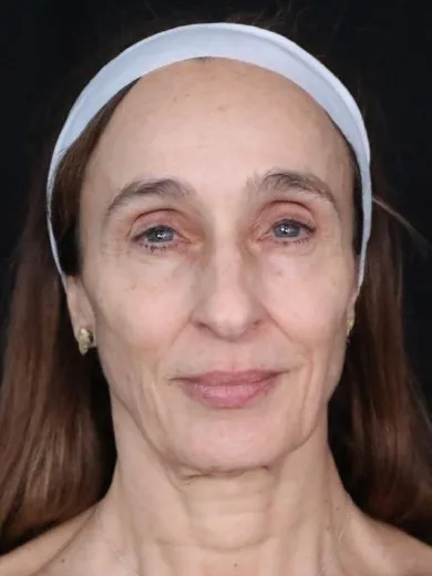 MILA patient recovery journey, Patient 4 — Pre-op