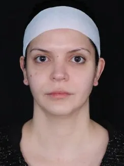 MILA patient recovery journey, Patient 5 — Pre-op